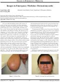 Cover page: Images in Emergency Medicine: Dermatomyositis