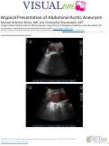 Cover page: Atypical Presentation of Abdominal Aortic Aneurysm