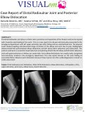 Cover page: Case Report of Distal Radioulnar Joint and Posterior Elbow Dislocation