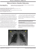 Cover page: Bilateral Inferior Shoulder Dislocation