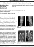 Cover page: A Rare Knee Fracture with Underestimated Severity