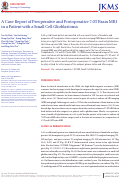 Cover page: A case report of preoperative and postoperative 7.0T brain MRI in a patient with a small cell glioblastoma.