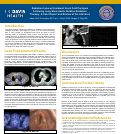 Cover page of Radiation Induced Unilateral Vocal Fold ParalysisFollowing Lung Stereotactic Ablative RadiationTherapy: A Case Report and Review of the Literature