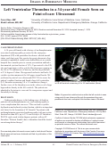 Cover page: Left Ventricular Thrombus in a 34-year-old Female Seen on Point-of-care Ultrasound