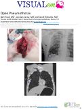 Cover page: Open Pneumothorax