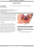 Cover page: Images in Emergency Medicine: Painful Red Eye