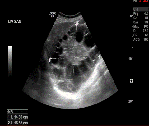 Sagittal imaging of anterior chest wall