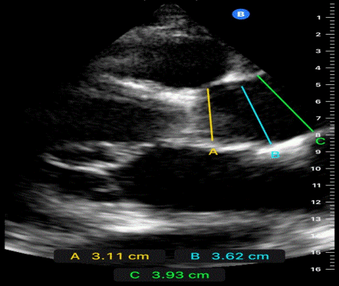  Figure 3: 