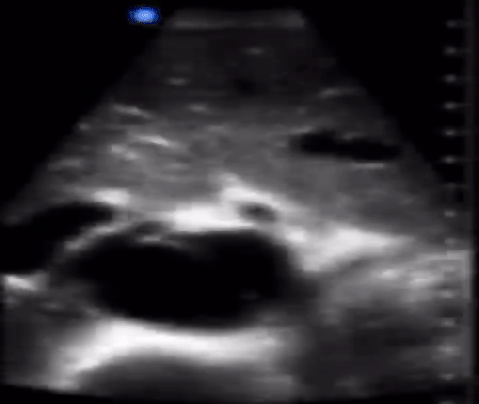  Figure 6: 