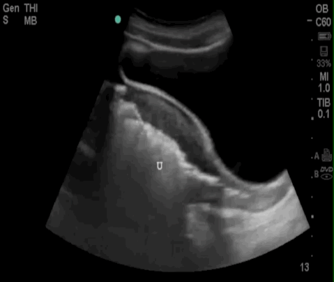  Figure 5 