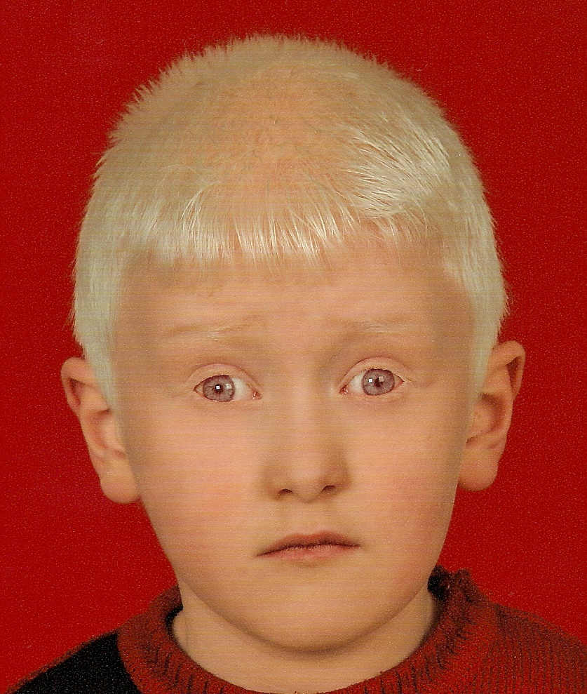 Альбинос человек фото с красными глазами