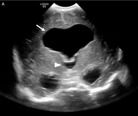  Coronal grey scale image 