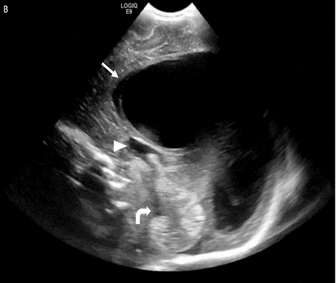  Sagittal grey scale image 