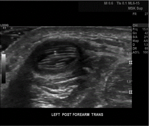  Figure 2: 