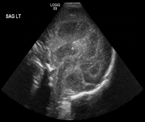  Sagittal head 