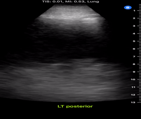 Figure 41