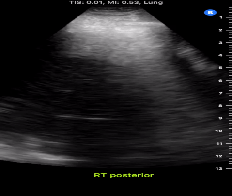  Figure 51 