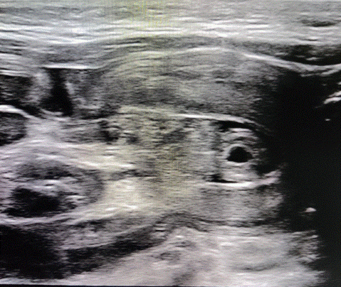  Image2 