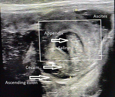  Image3 