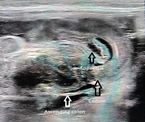  Image4 