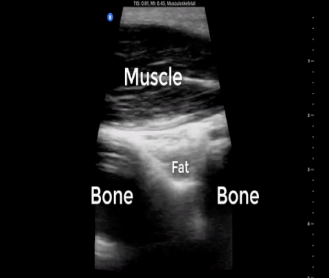  Non-injured distal arm for comparison. 