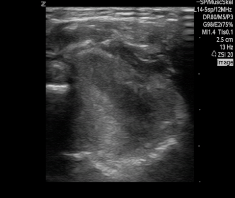  Non-injured distal arm for comparison. 