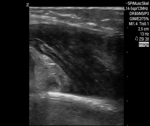  Non-injured distal arm for comparison. 