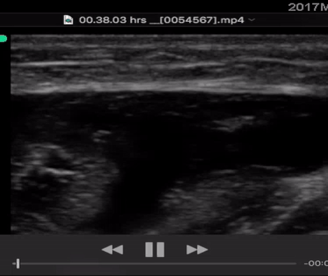 the posterior thigh 