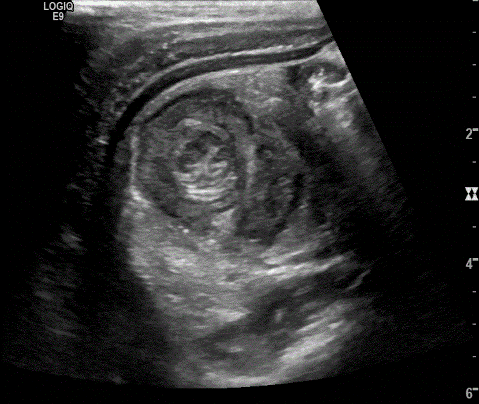  Image1 