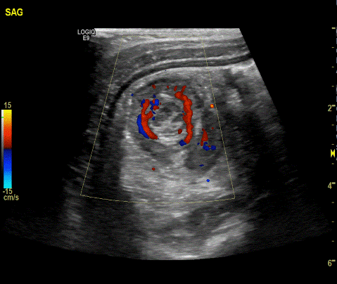  Image2 