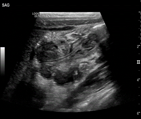  Image3 