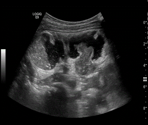  Image4 