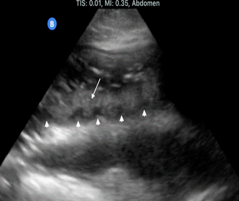  Figure 3 