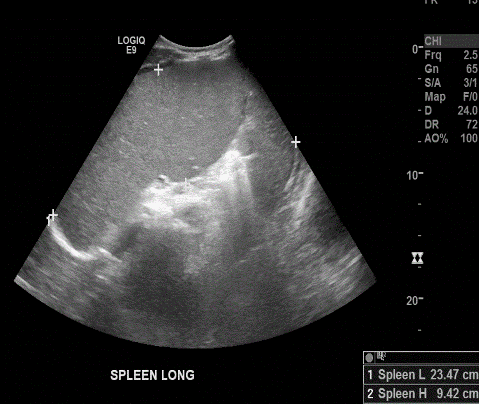  Image2 