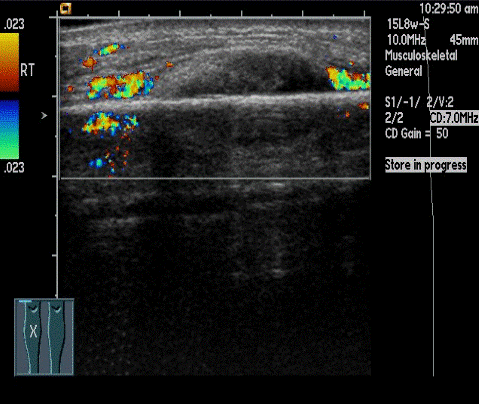  Figure 3 