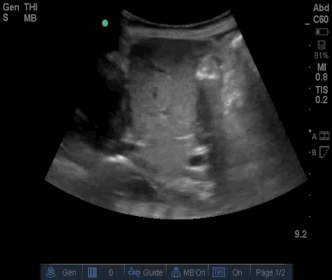  video 1 