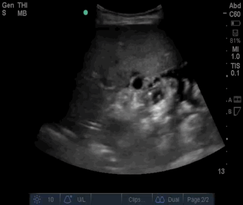  Video 3 