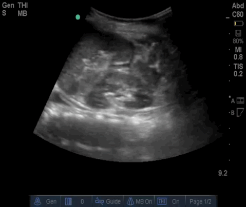  Video 4 