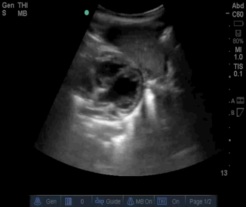  Video 5 