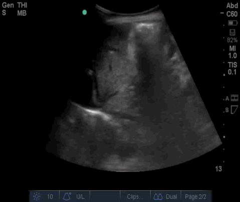  Video 6 