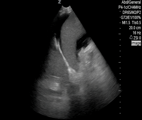  Figure 2: 
