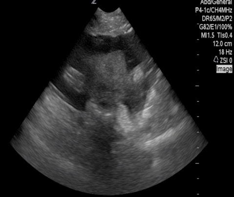  Figure 3: 