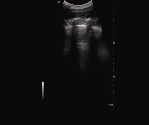 Sagittal imaging of anterior chest wall