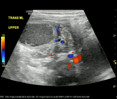  Figure 2: 