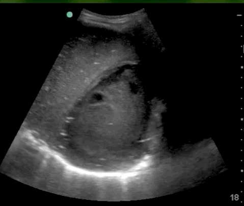  Image1.gif 