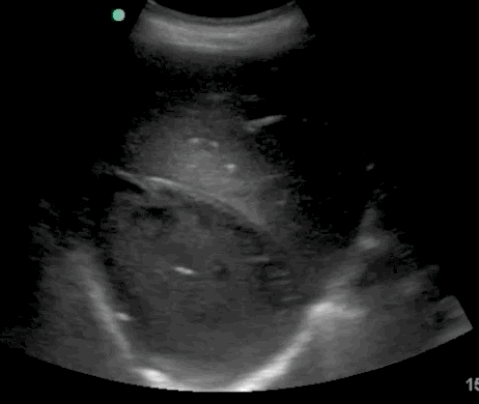  Image3.gif 