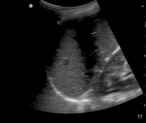  Image4.gif 